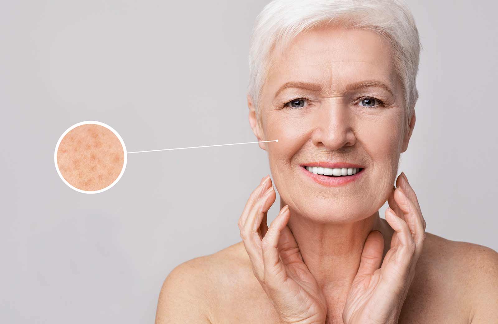 taches de vieillesse taches de vieillesse