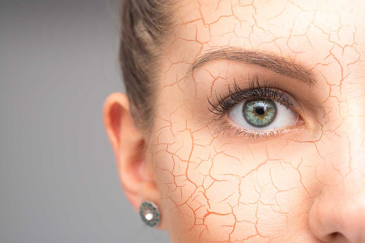 problème de peau sèche problème de peau sèche