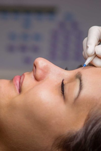 electrolyse-opt electrolyse-opt